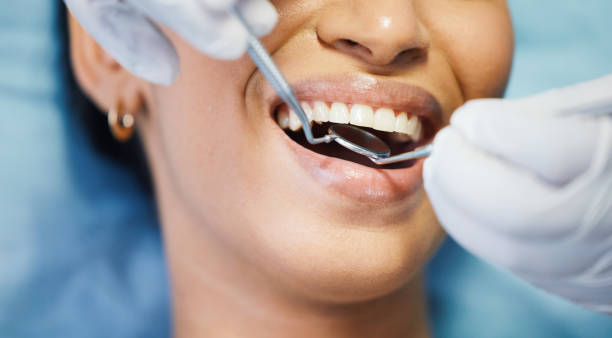 Best Emergency Dental Extractions in Avalon, NJ